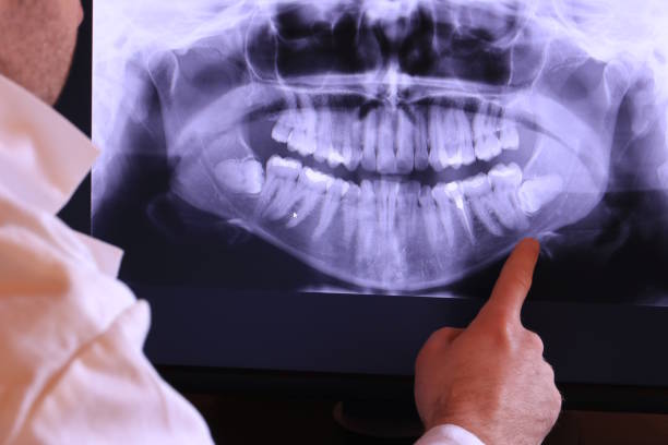 Best Urgent Dental Care for Toothache in West Point, UT